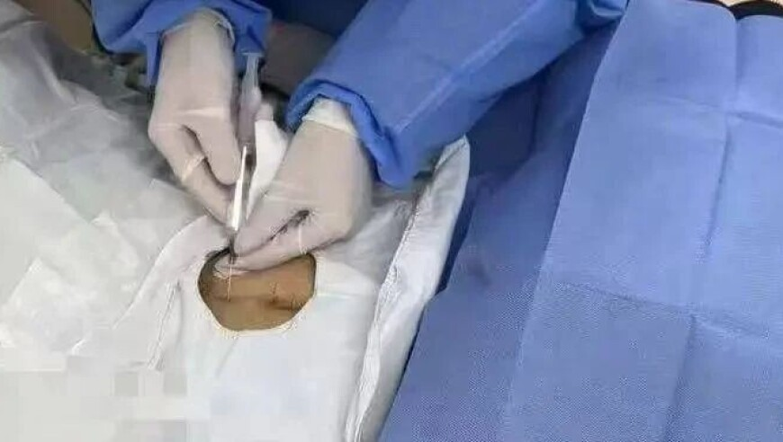 澳门一肖一码100准免费资料澳,在以美之名看到了整形修复的意义,收益成语分析落实_基础版V1.78